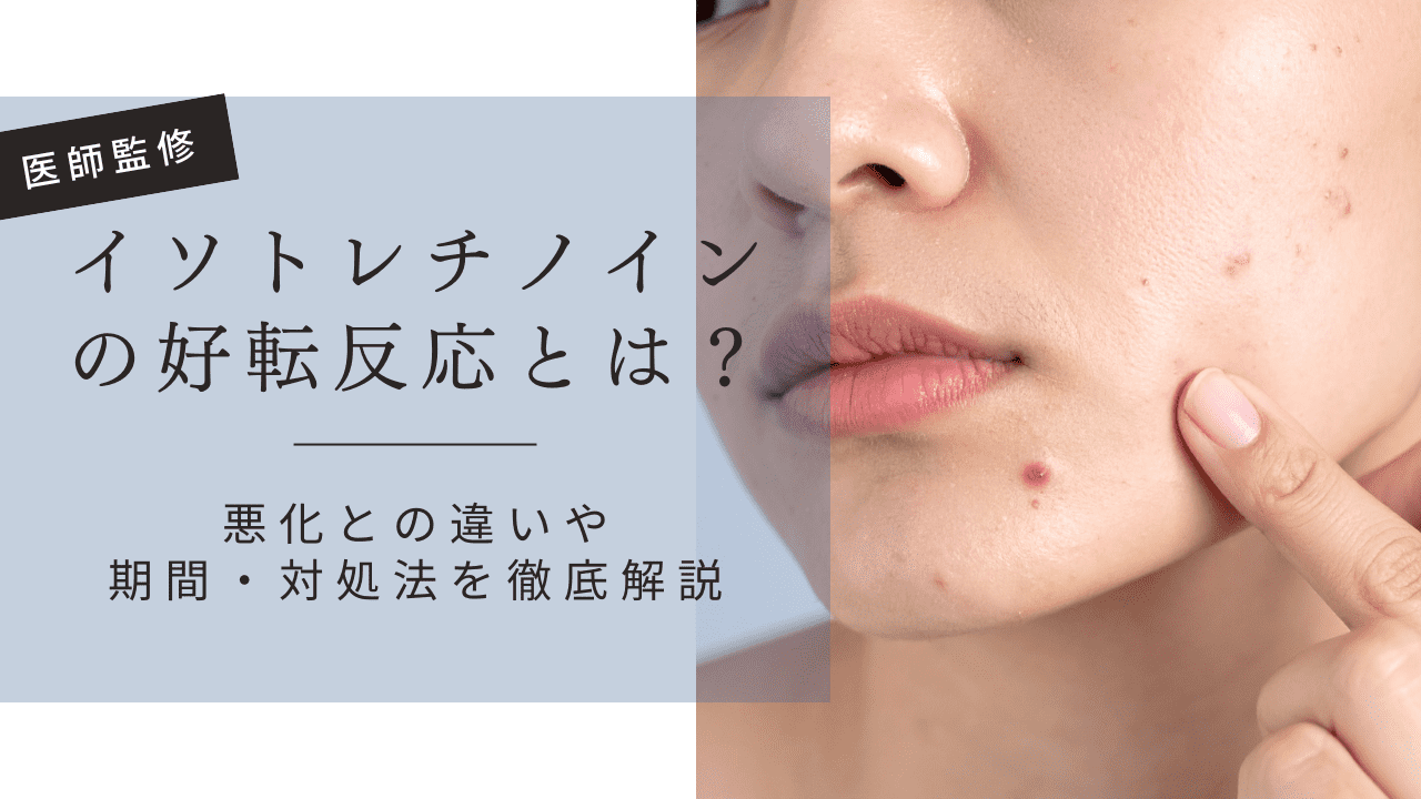イソトレチノインの好転反応とは?悪化との違いや期間・対処法を徹底解説