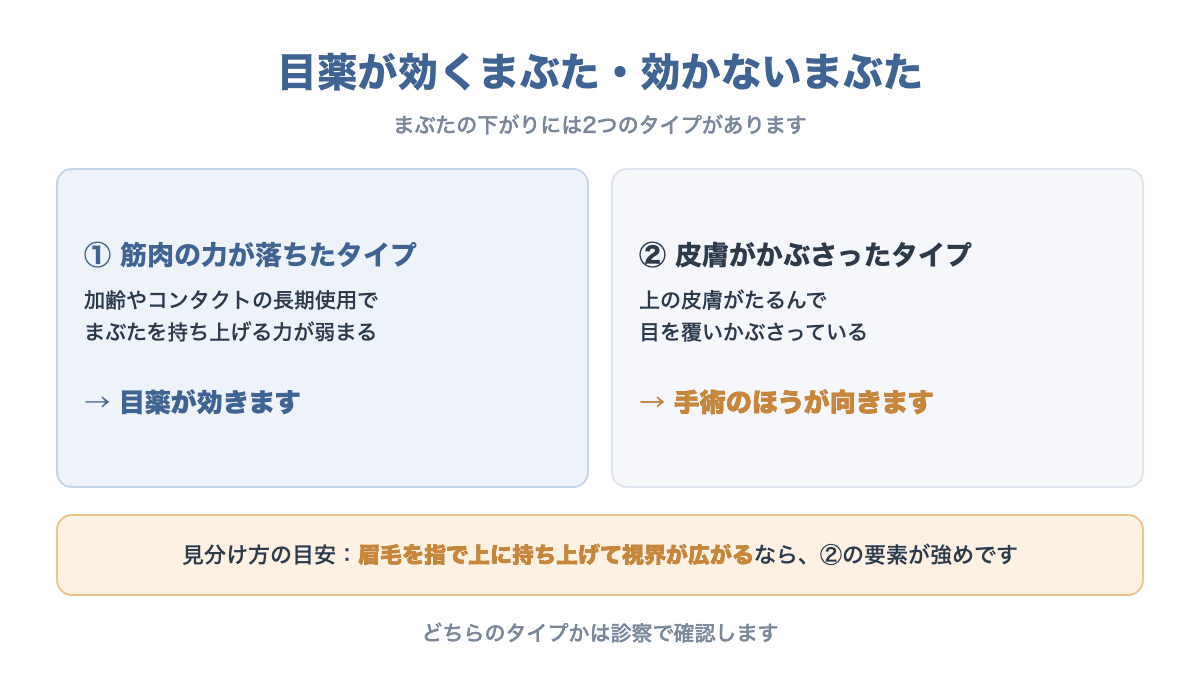 まぶたの下がりには筋肉の力が落ちたタイプと皮膚がかぶさったタイプがあり、目薬が効くのは前者であることを示す図
