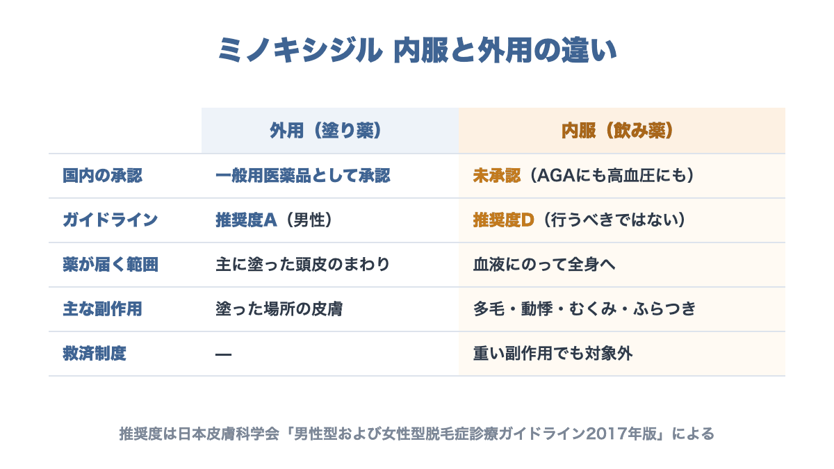 ミノキシジルの内服と外用の比較表。外用は国内で一般用医薬品として承認されガイドライン推奨度A、内服は国内未承認で推奨度D。内服は全身に届くため多毛や動悸、むくみなどが出ることがある